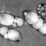 PHA producing bacteria