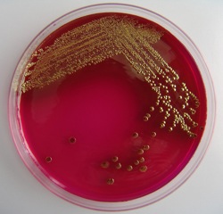 De E.coli-bacterie is het werkpaard binnen SynBio. Foto: FreeImages.com/Renata Horvat