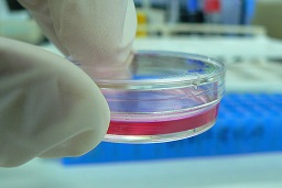 Cell culture in Petri dish