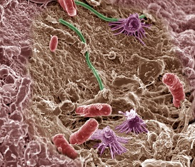 microbiome of the soil