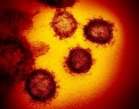 SARS Coronavirus