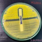 Lysozyme  kills innocuous bacteria as M.Luteus living on our skin, but harmful bacteria like Stafyloccocus Aureus, causing  hazardous infections, are left untouched (Shutterstock: 1805490295).