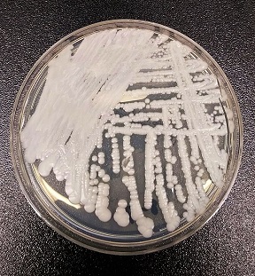 schimmelinfecties
