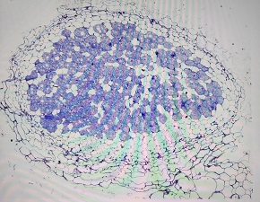 rhizobia