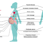 Exposure to PFAS