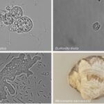 CRISPR-Cas